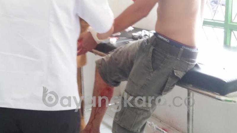 Monyet Serbu Rumah Warga di Sergai, 5 Orang Kena Gigit