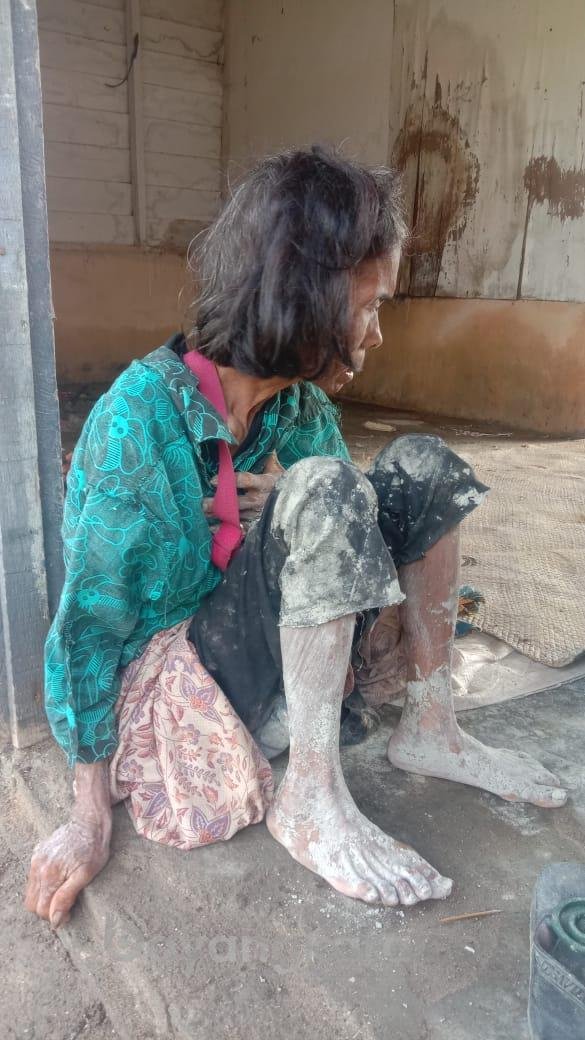 Lewati Jalan Rusak Parah perbatasan Kapal Merah Kecamatan Nibung Hangus Kabupaten Batu Bara, Tim Medis Bersama PBB Dan SB-4 Evakuasi Nek Darmawati.