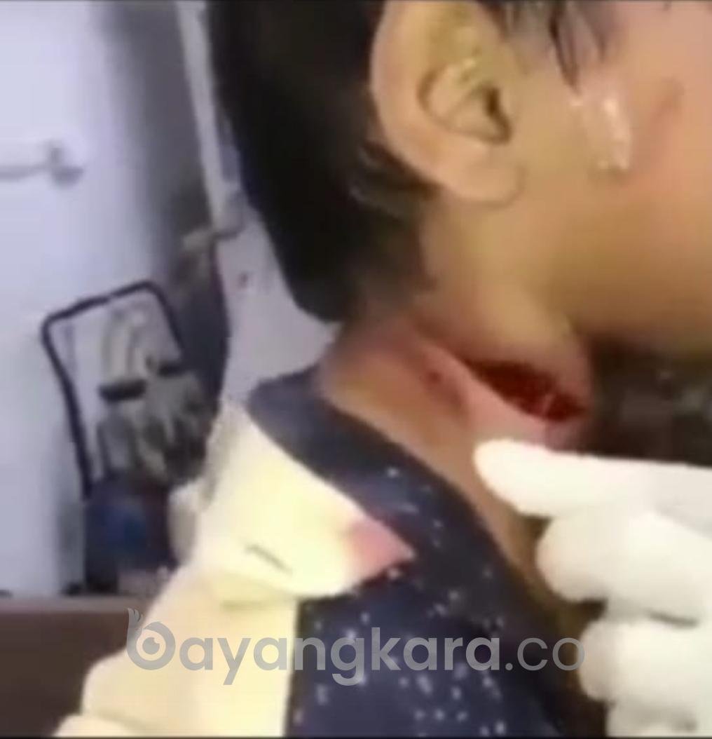 Lapor Pak Kapolda ! Heboh Beredar Vidio Viral Penculikan Anak Di Bali