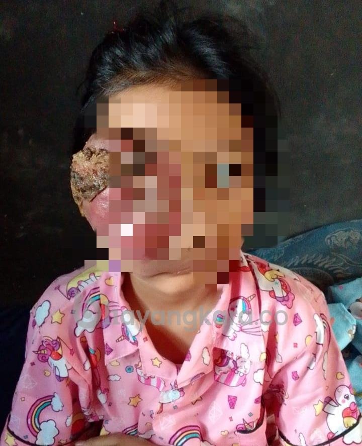 SITI AZMIRA DEA NOVA BUTUH PENANGAN RUMAH SAKIT, KELUARGA BERHARAP GUBERNUR JAWA BARAT RIDWAN KAMIL MEMBERI BANTUAN. 