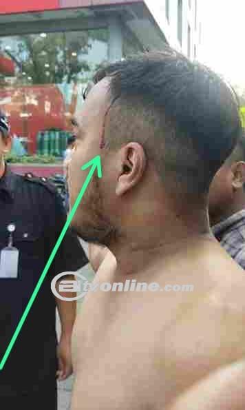Wartawan Dianiaya di Medan, Polisi Diminta Bertindak