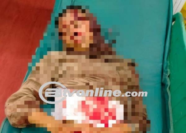 HOAX! Viral Seorang Perempuan Jadi Korban Perampokan di Peureulak dan Idi Rayeuk, Ini Faktanya