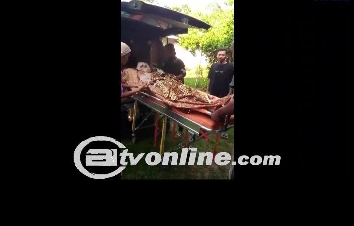 Cemburu Buta, Suami Tega Siram Air Keras ke Istrinya di Cilacap