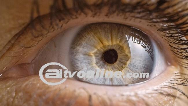 Gejala Kanker Paru Tidak Biasa, Kehilangan Penglihatan Sebelah