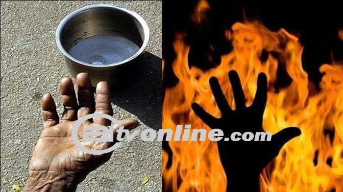 Jasad Pengemis Kebakaran Tak Diambil Keluarga, Pasrah Karena Keterbatasan Uang