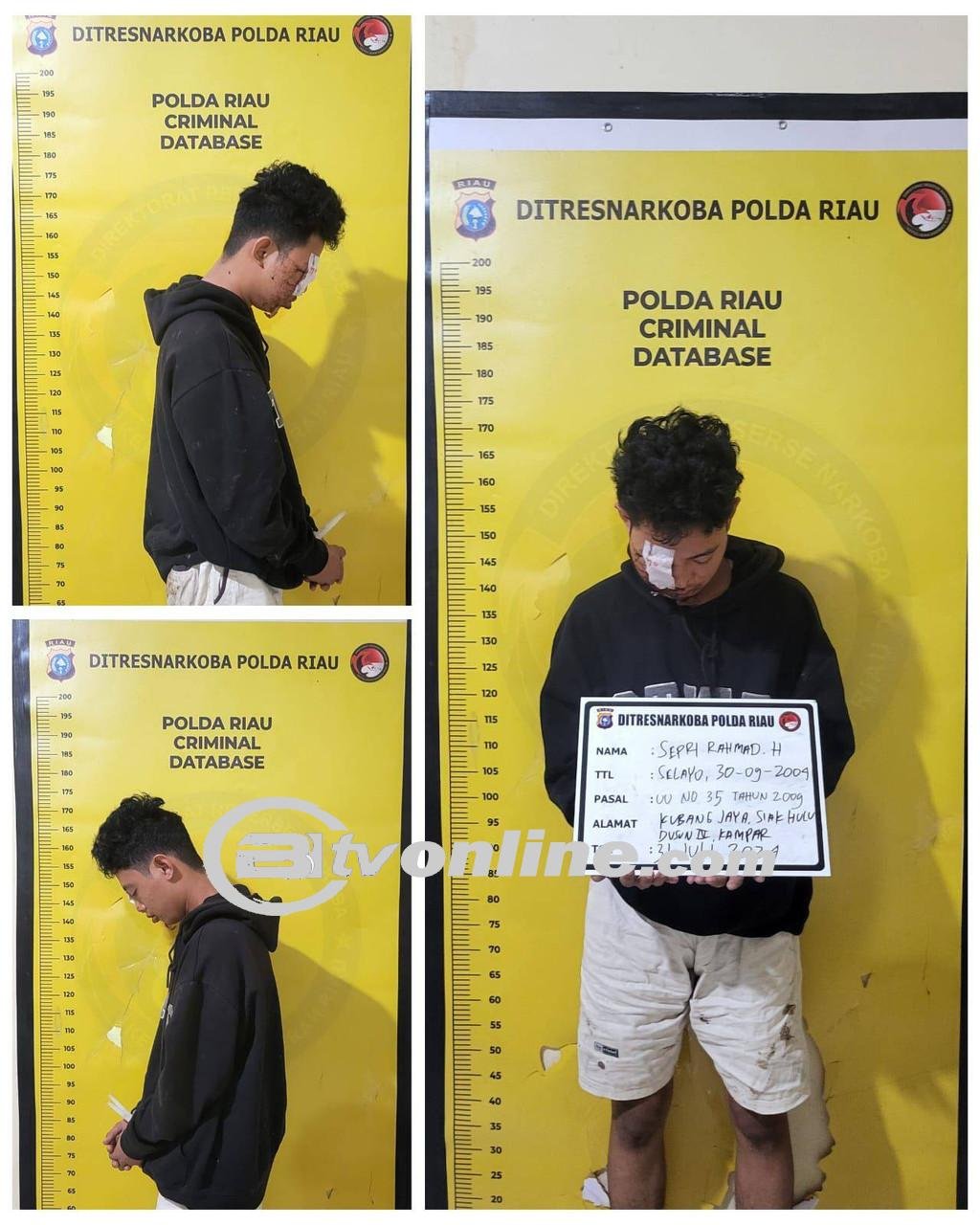 Kurir Narkoba Tabrak Pohon Saat Dikejar Polisi di Pekanbaru Wajah Sampai Dijahit!