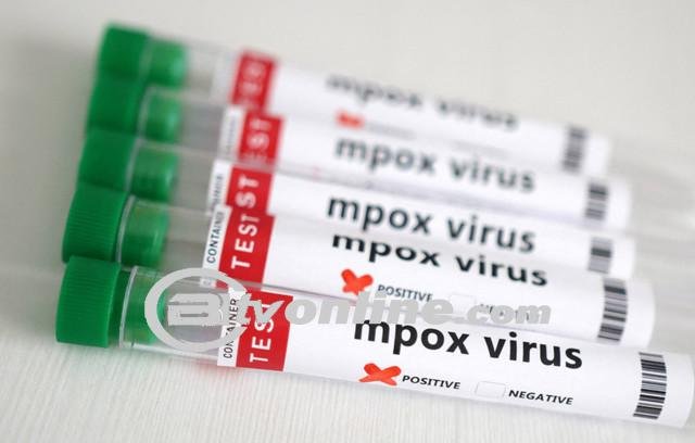 BPOM Beri Akses Khusus untuk 3 Obat Cacar Monyet ke Indonesia