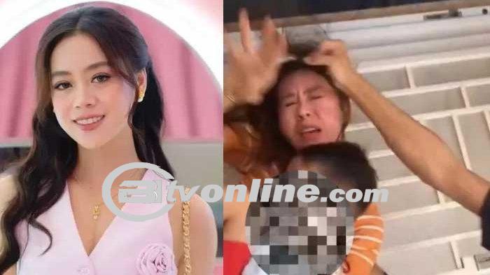 Anastasia Noor: Selebgram Lampung yang Diduga Dianiaya Mantan Suami!