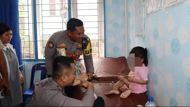 Hasil Rontgen Bocah Cacat di Nias Selatan Tunjukkan Kelainan Bawaan, Polisi Tangani Dugaan Kekerasan