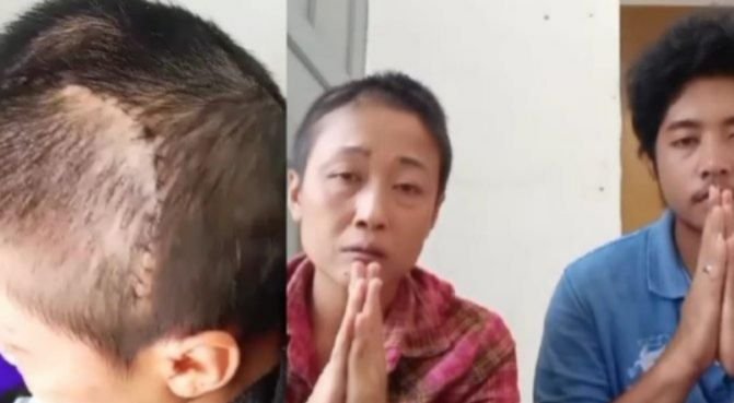 Viral! Kasus Penganiayaan di Samosir, Polres Bongkar Fakta: Erni Nainggolan Kecelakaan Bukan Dianiaya