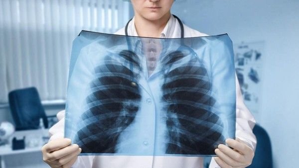 Mengenal Pneumonia: Penyakit Paru-Paru yang Bisa Mematikan!