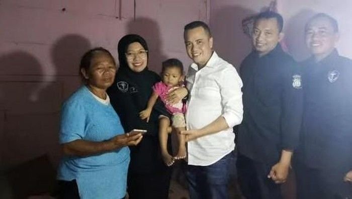 Polda DIY Jemput Balita Ningsih untuk Perawatan Tumor di RS Bhayangkara