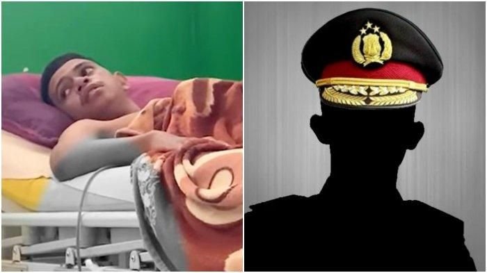 6 Bintara Polisi di Polres Baubau Aniaya Juniornya, Bripda A Terpaksa Dirawat di Rumah Sakit