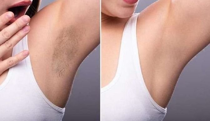 Tips Ampuh Memutihkan Ketiak Secara Alami dan Efektif!