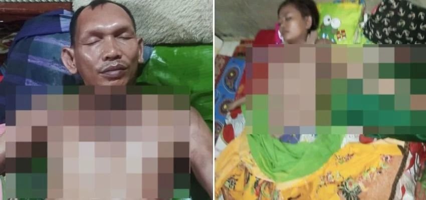 Sekdes di Padangsidimpuan Bakar Pacar karena Cemburu, Kini Jadi Tersangka