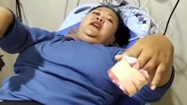 Karyawati Pabrik Tewas Usai Operasi Jari, Dinkes Karawang Telusuri Dugaan Kelalaian RS