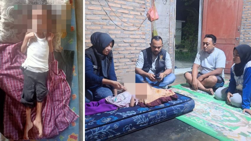 Miris! Bocah 5 Tahun di Batu Bara Lumpuh, Program UHC Dipertanyakan! 9 Hari Dirawat Rs Adam Malik Pasien Disuruh Pulang