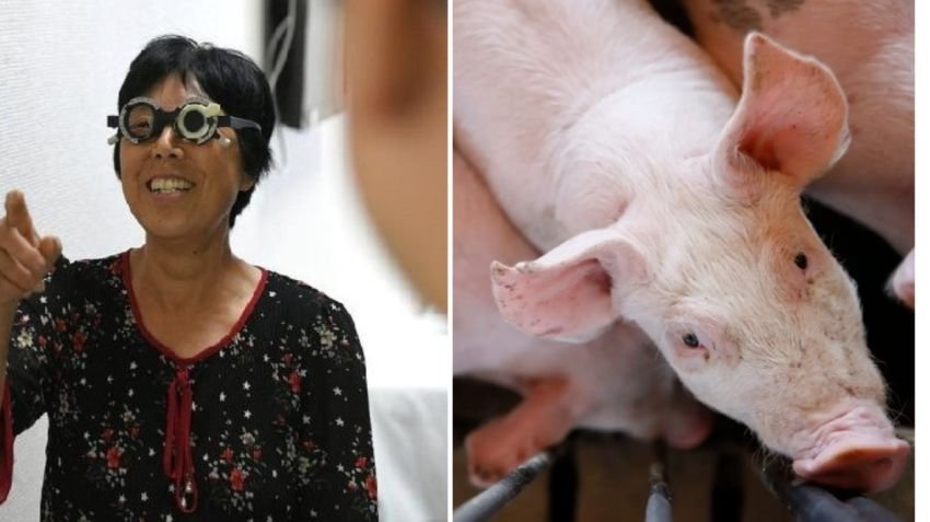 Wanita Cina Pertama di Dunia yang Terima Transplantasi Kornea Babi Kini Bisa Melihat Kembali
