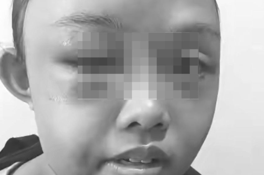 Tr4gis! G4d1s Yatim Piatu Ini Disiksa Tantenya, Tak Diberi Makan dan Tidur di Gudang!