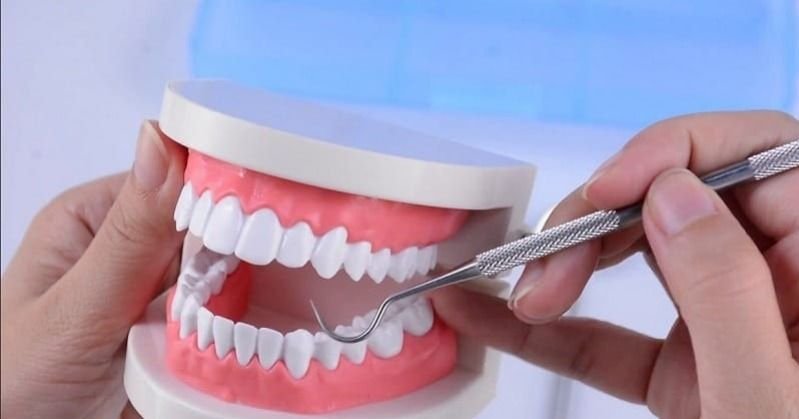 Ketahui Daftar Perawatan Gigi yang Ditanggung BPJS Kesehatan