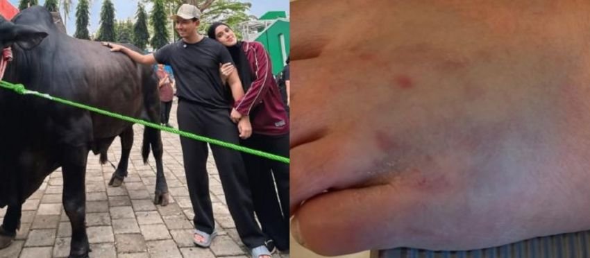 Fairuz A. Rafiq Dilarikan ke RS Usai Kakinya Keinjak Sapi 1,2 Ton Hadiah dari Raffi Ahmad