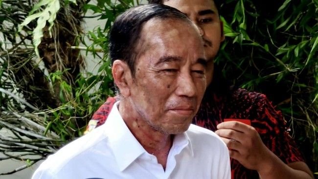 Ulang Tahun ke-64 Jokowi Dirayakan Sederhana, Warga Solo Doakan Kesembuhan