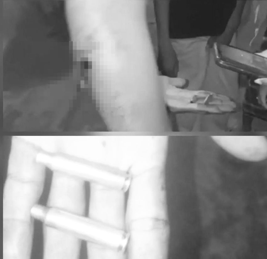 Dua Warga Terluka Diduga Akibat Peluru Karet saat Polisi Bubarkan Tawuran di Medan Labuhan