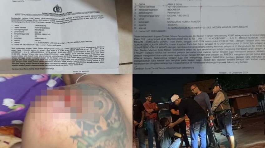 Warga Mangkubumi Jadi Korban Pengeroyokan, Alami Luka Serius hingga Gigi Patah