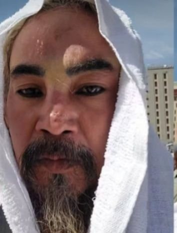 Nyentrik Bikin Panik! Limbad Sempat Dihentikan Petugas Imigrasi Arab Saudi karena Gigi Taring?