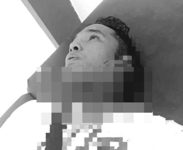 Miris! Pedagang Bakso Keliling Dibacok Preman di Padangsidimpuan Gara-Gara Uang Rp10 Ribu