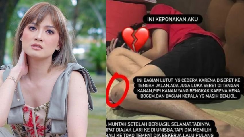 Chika Jessica Ungkap Keponakannya Jadi Korban Pemukulan Polisi saat Kejar Pendemo di Bandung