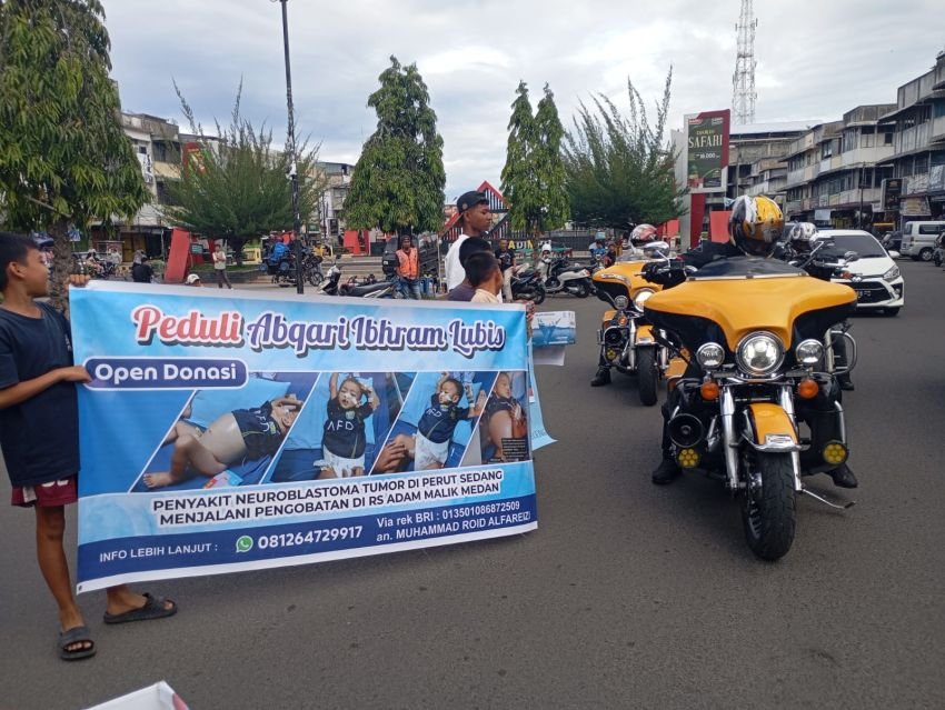Menyentuh! Rombongan Moge Beri Donasi untuk Balita Penderita Tumor Perut di Padangsidimpuan