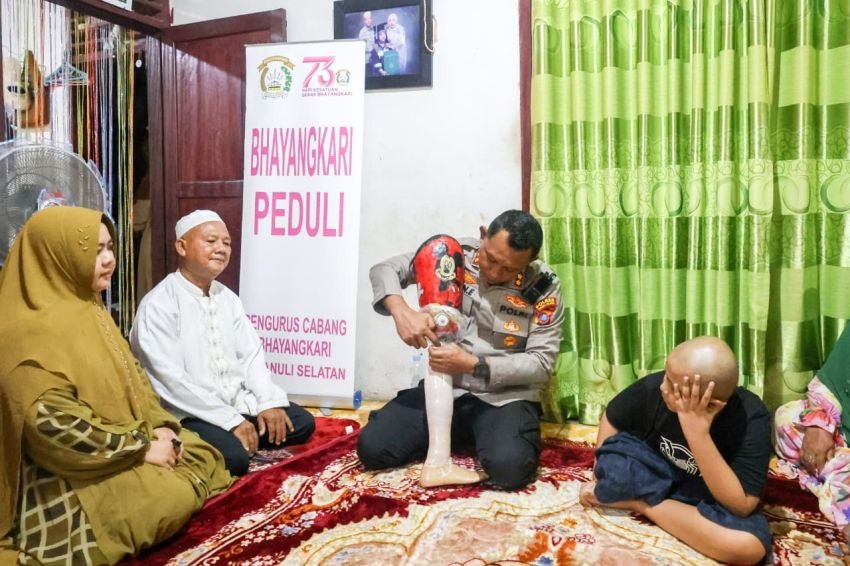 Momen Haru, Kapolres Tapsel Serahkan Kaki Palsu untuk Anak Personel