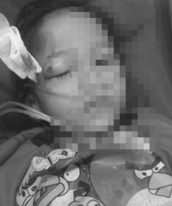 Mata Balita Terluka, Diduga Tertembak Peluru Nyasar Saat Tawuran Antar-Kampung di Belawan