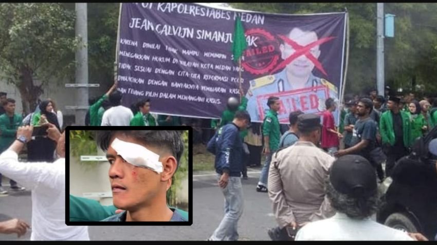 Ricuh di Mapolrestabes Medan, Dua Kader Mahasiswa Al Washliyah Luka Robek Saat Aksi Protes Copot Kapolrestabes