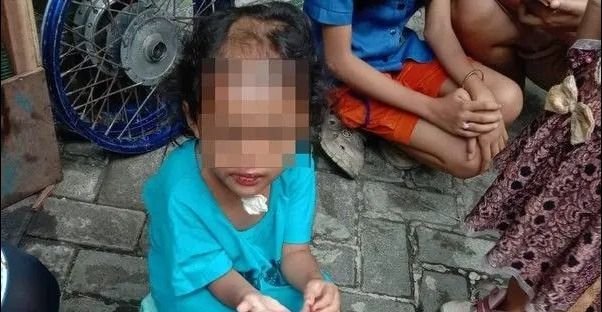 Tragedi Balita 4 Tahun di Surabaya: Paman dan Bibi Botaki dan Aniaya Keponakan Selama 2 Bulan, Polisi Masih Dalami Motif