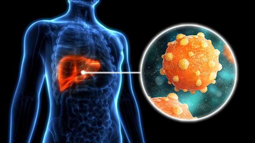 6,7 Juta Orang di Indonesia Terinfeksi Hepatitis B, Kenali Cara Penularan dan Pencegahannya!