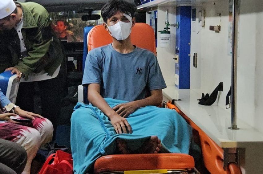 Kepala Bocor 12 Jahitan & Punggung Disundut Rokok! Cerita Pilu Pelajar Korban Kericuhan Pejompongan