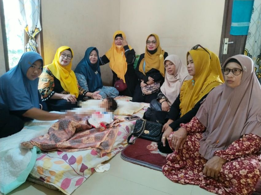 PB Puan MABMI Serahkan Bantuan untuk Kayla, Gadis Cilik Korban Luka Bakar di Batu Bara